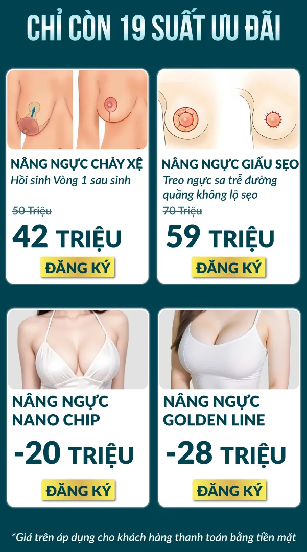 img-promotion-1