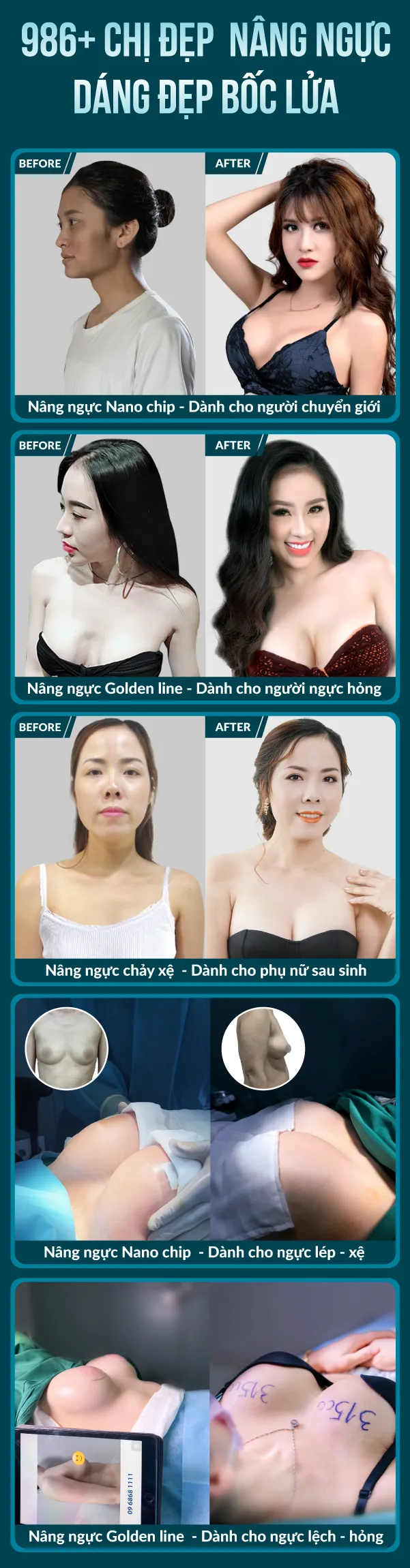 img-promotion-2