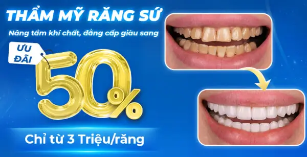 Đăng ký khuyến mãi bọc răng sứ JW