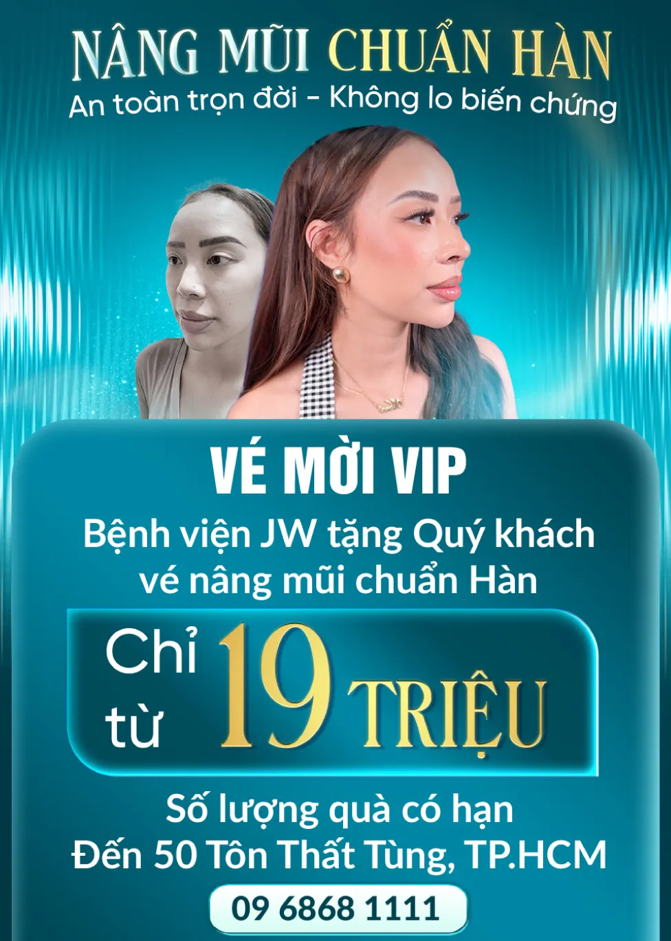 Banner đăng ký thành công Nâng mũi S line - Mobile