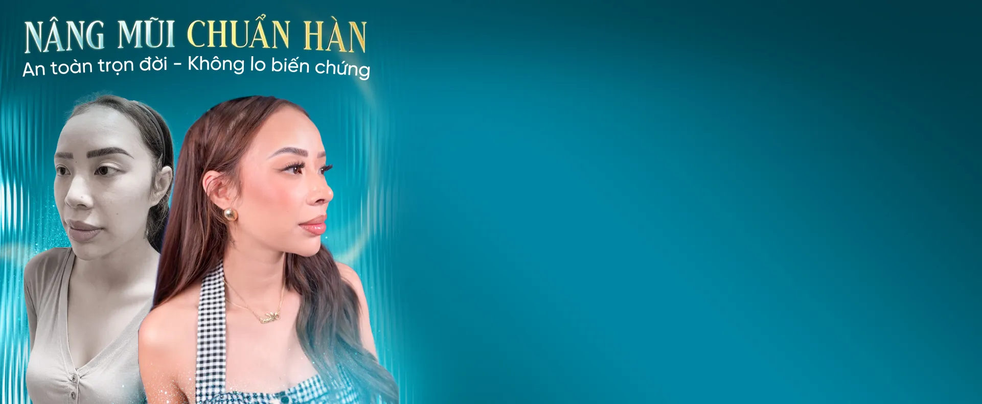 Banner đăng ký thành công Nâng mũi S line - Desktop