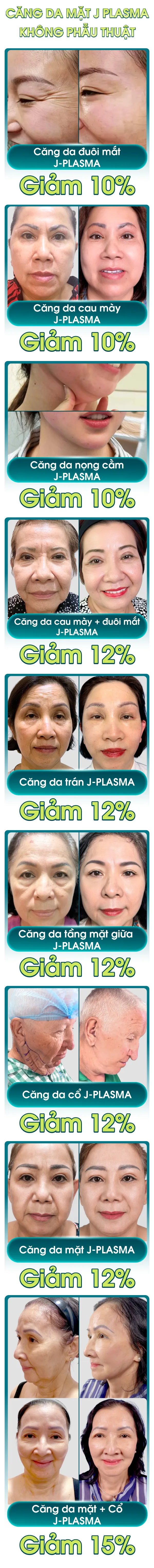 Hình ảnh danh sách voucher ưu đãi sinh nhật 26 năm của Bệnh viện JW