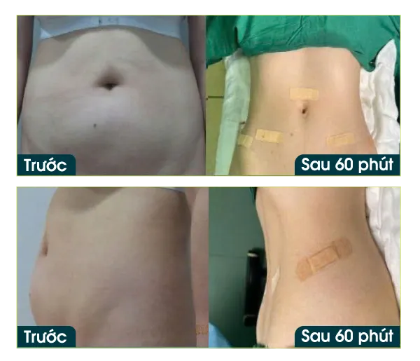 Hình ảnh danh sách voucher ưu đãi sinh nhật 26 năm của Bệnh viện JW