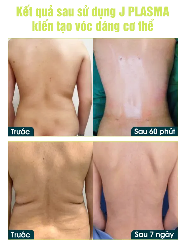 Hình ảnh danh sách voucher ưu đãi sinh nhật 26 năm của Bệnh viện JW