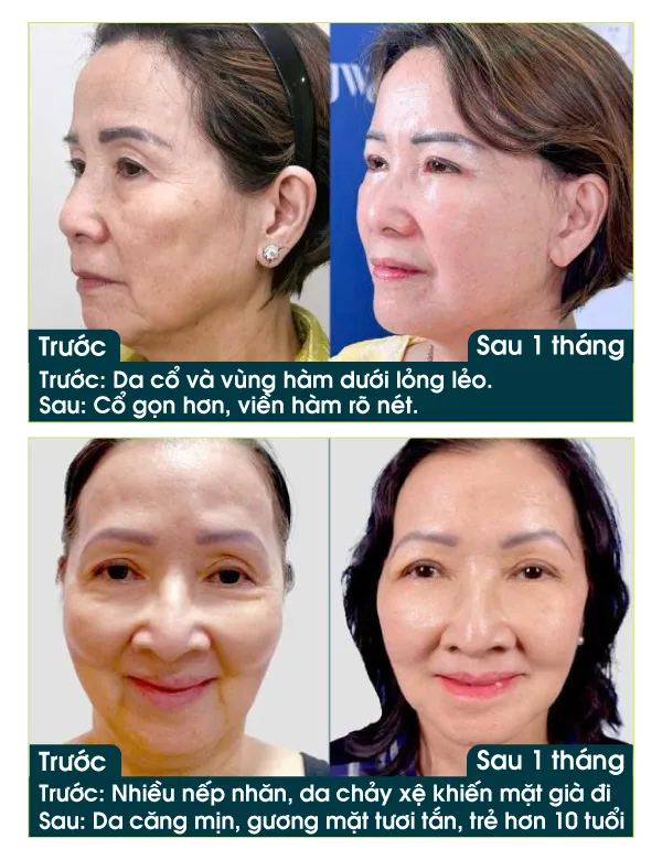 Hình ảnh bánh sinh nhật thật nhiều ưu đãi của Bệnh viện JW