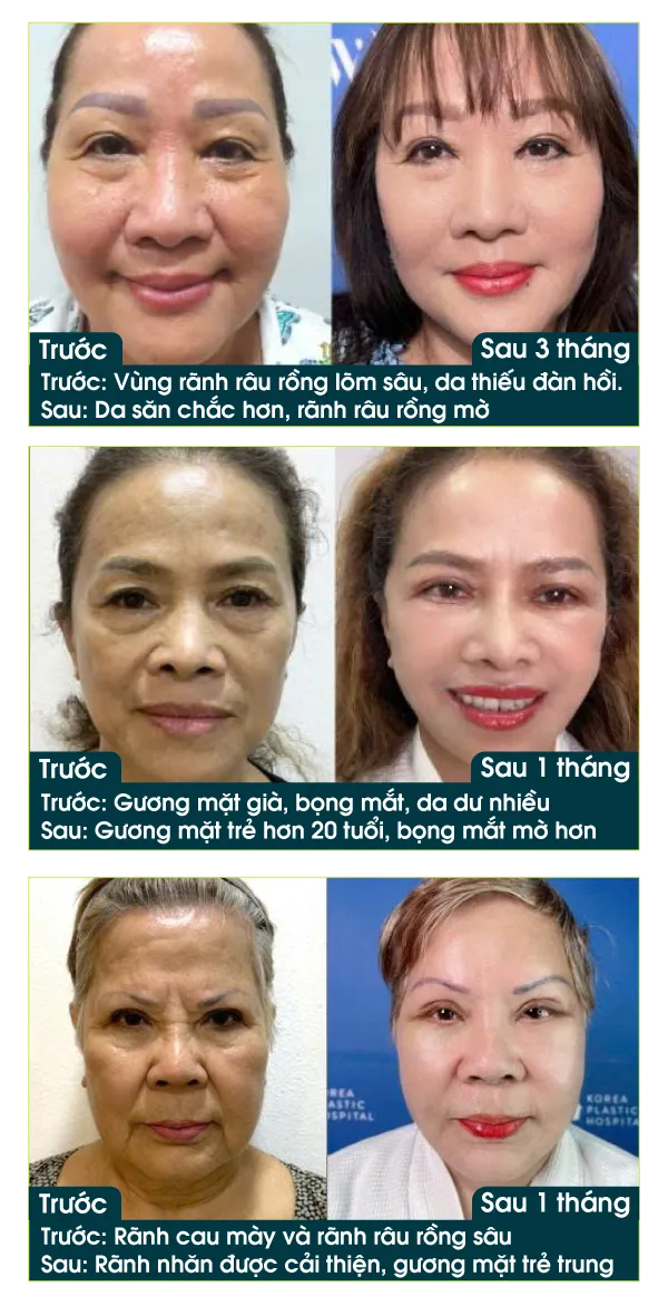 Hình ảnh các vouchers ưu đãi lớn nhất của Bệnh viện JW