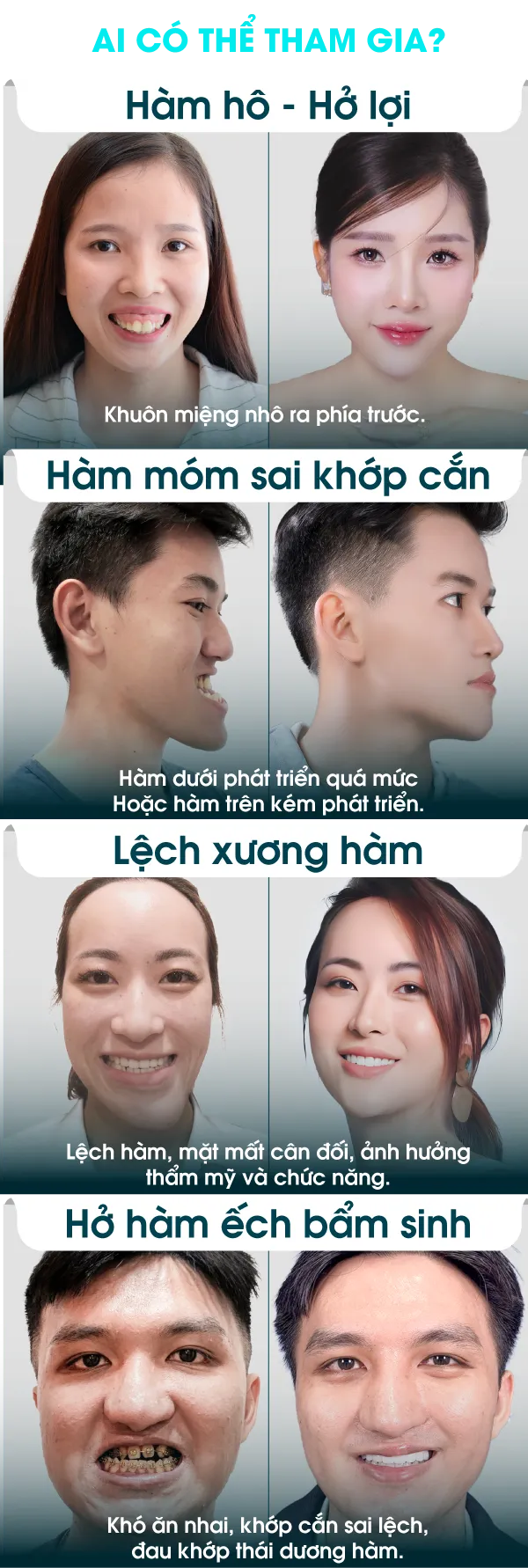 Hình ảnh ai có thể tham gia phẩu thuật hàm tại Bệnh viện JW