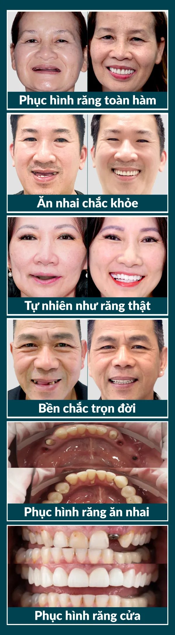 Hình ảnh section 2