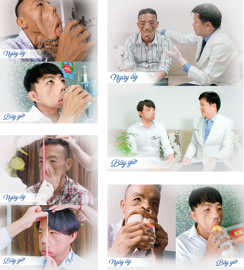 Tìm lại cuộc sống cho Anh Mến