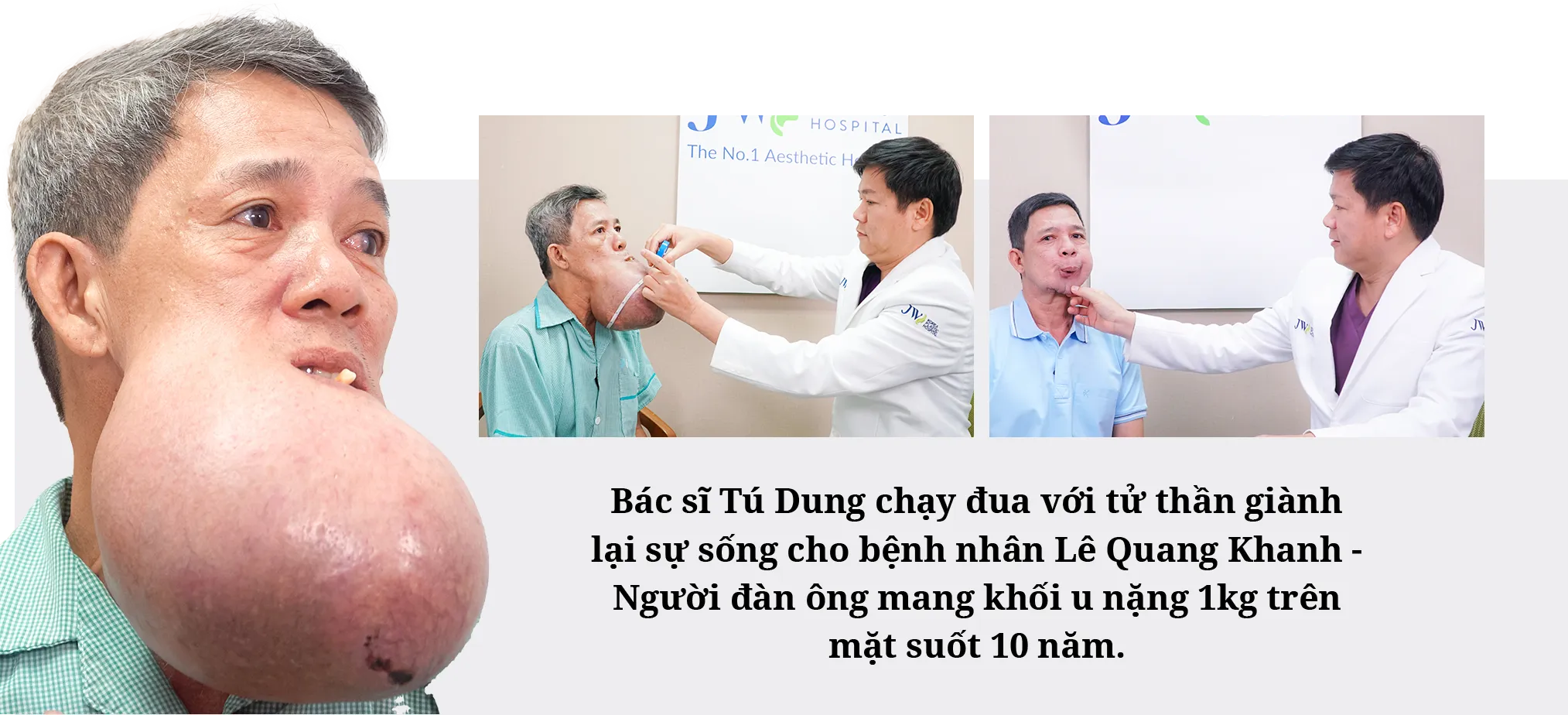 Case chú Khánh