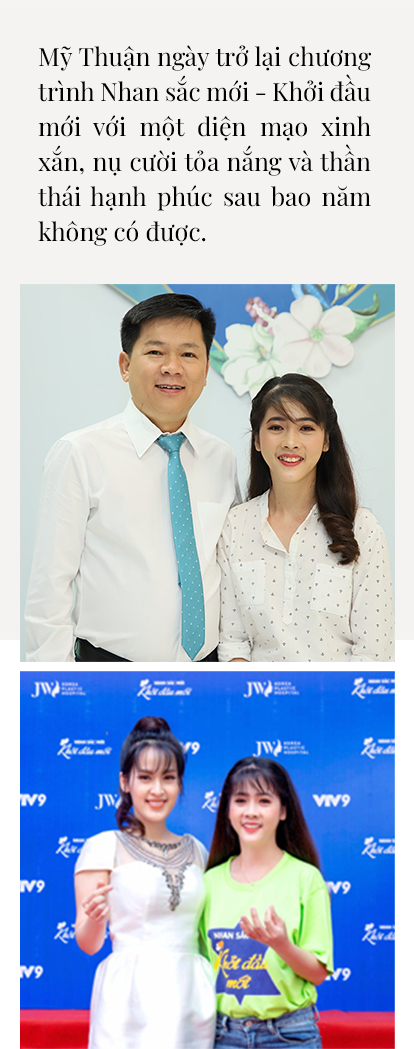 Mỹ Thuận phẫu thuật hàm hô