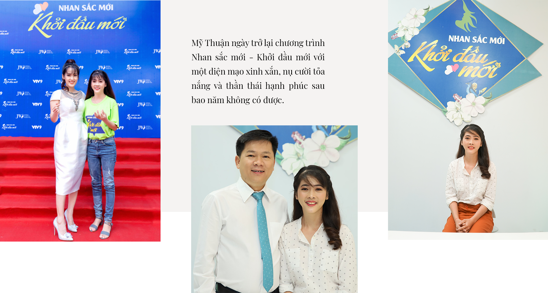 Mỹ Thuận phẫu thuật hàm hô