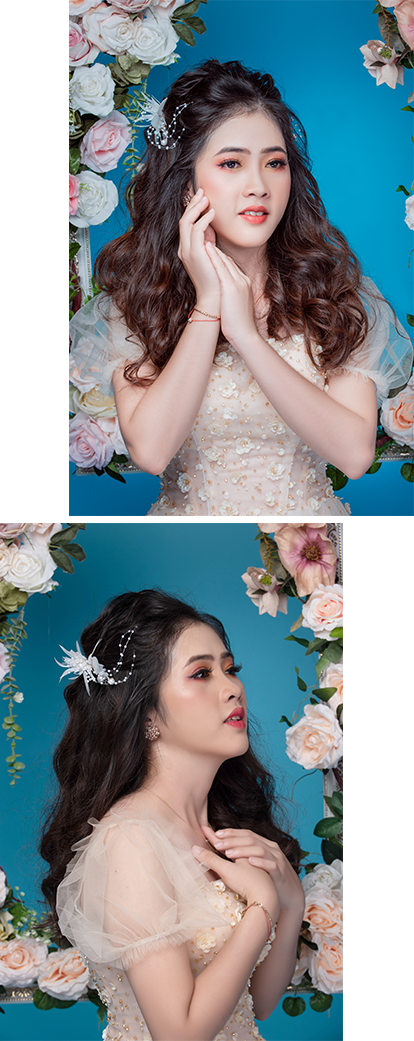 Mỹ Thuận phẫu thuật hàm hô