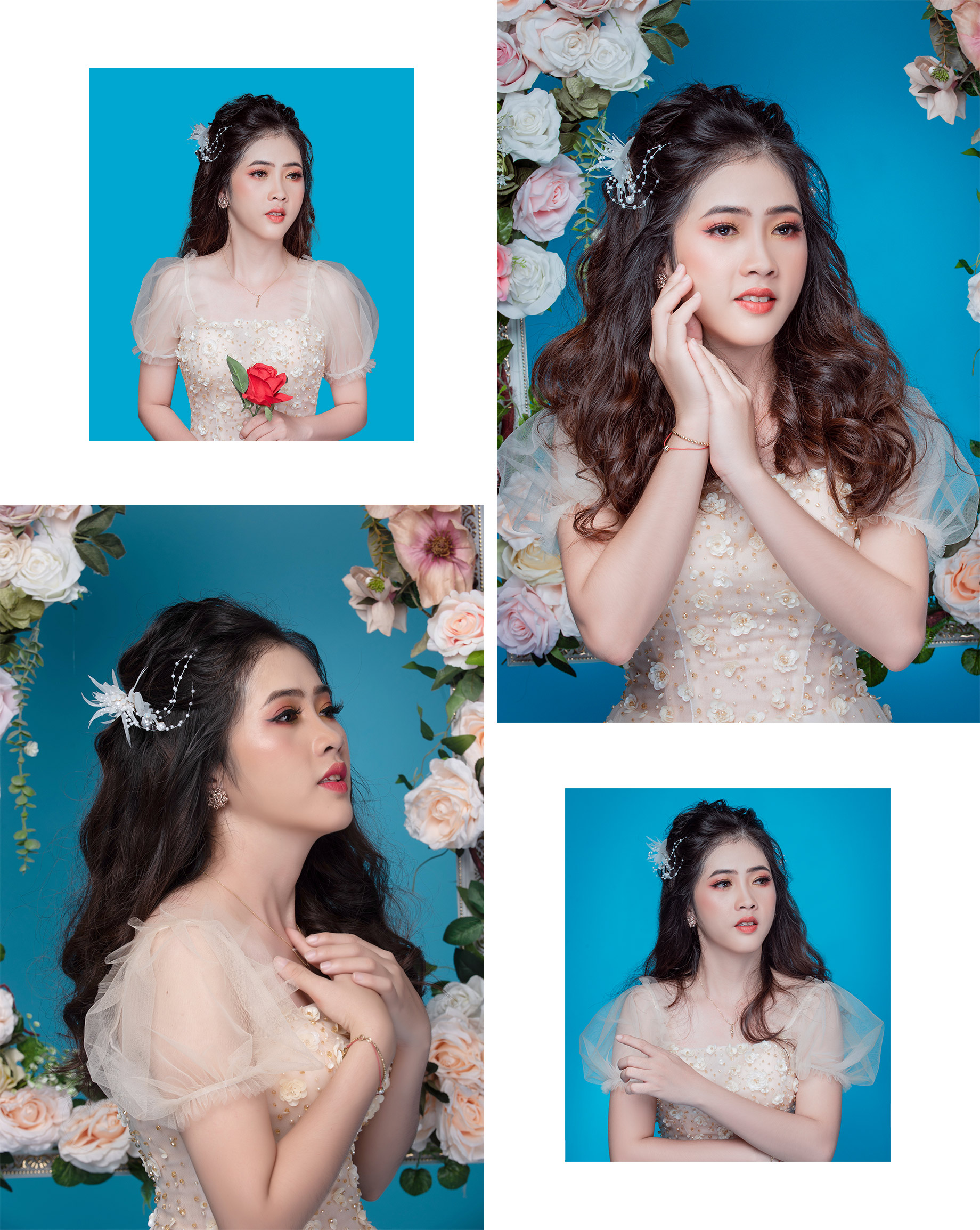 Mỹ Thuận phẫu thuật hàm hô