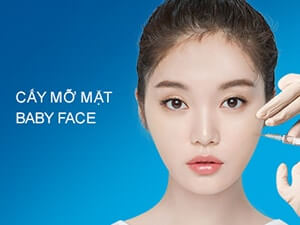 Cấy mỡ mặt Baby Face