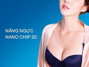 Nâng ngực nano chip 3D