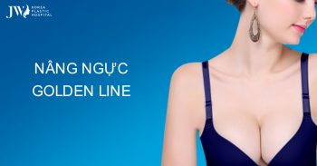 Công nghệ nâng ngực Golden Line – xu hướng thẩm mỹ 2025
