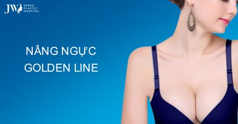 Công nghệ nâng ngực Golden Line – xu hướng thẩm mỹ 2025