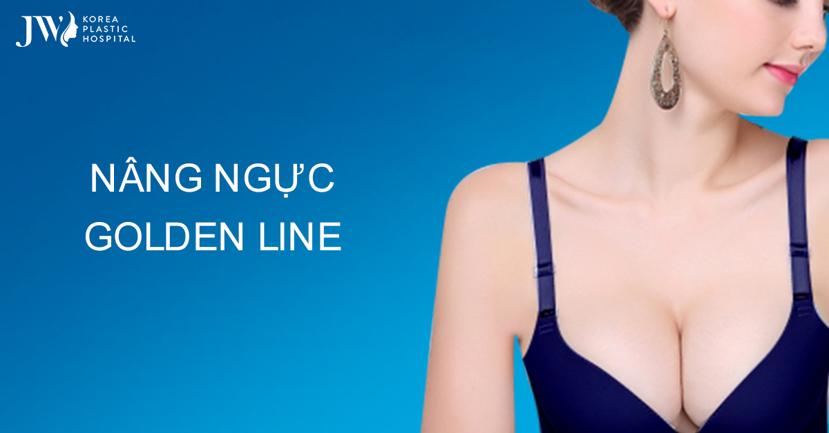 Công nghệ nâng ngực Golden Line – xu hướng thẩm mỹ 2025