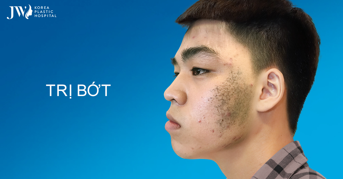 Trị bớt bẩm sinh tại bệnh viện JW an toàn, hiệu quả rõ rệt