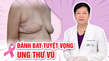 Bệnh viện JW tài trợ 100% cho phụ nữ tái tạo ngực