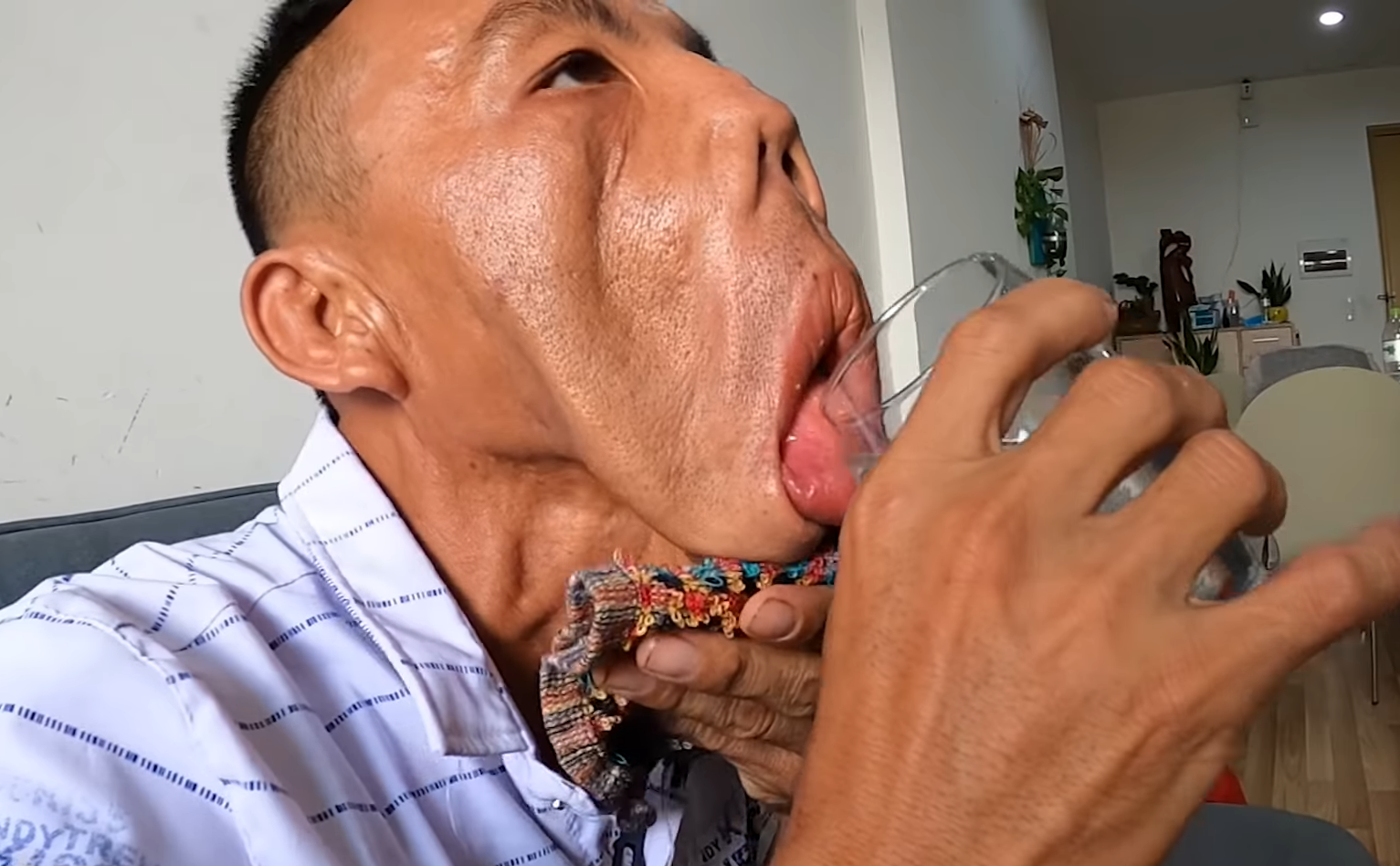 Tia hi vọng của anh Mến sau 15 năm bị xa lánh và chối từ