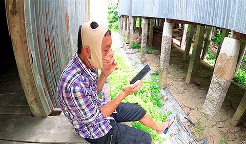 Anh Mến khoe chiến tích với Bác sĩ Tú Dung sau 3 ngày đeo đai nâng mặt chảy xệ