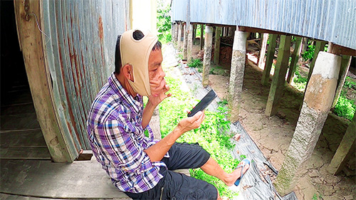 Anh Mến khoe chiến tích với Bác sĩ Tú Dung sau 3 ngày đeo đai nâng mặt chảy xệ