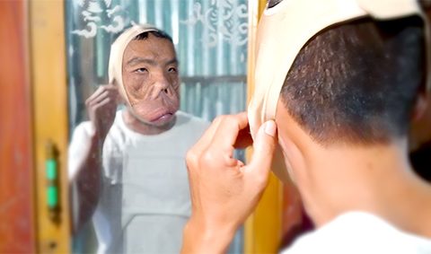 ANH MẾN ĐEO ĐAI NÂNG MẶT CHẢY XỆ MỚI, GƯƠNG MẶT GỌN HƠN NHIỀU