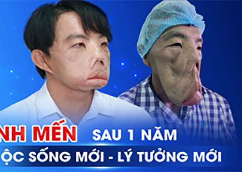 Sau 3 cuộc đại phẫu, anh Mến năm ấy giờ ra sao?