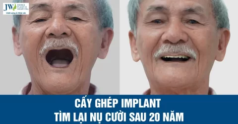 Cấy ghép implant giúp cựu chiến binh tìm lại nụ cười sau hơn 20 năm