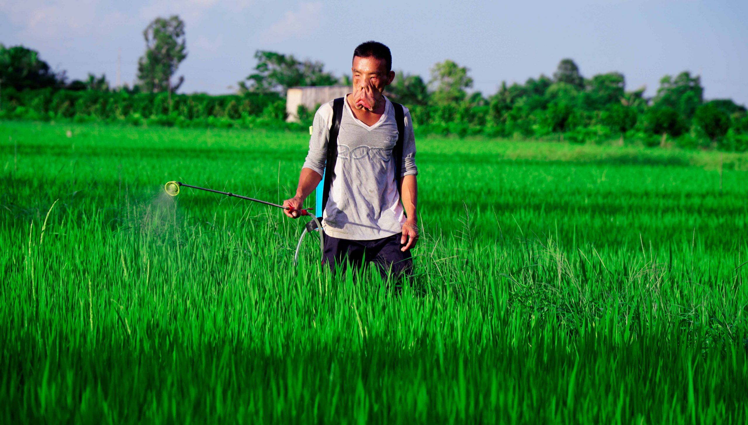 Anh Mến và khát vọng thoát khỏi danh phận “Chàng trai mặt quỷ”