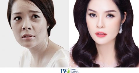 Dương Cẩm Lynh: “Dù bận rộn, tôi vẫn lựa chọn JW để chăm sóc sắc đẹp”