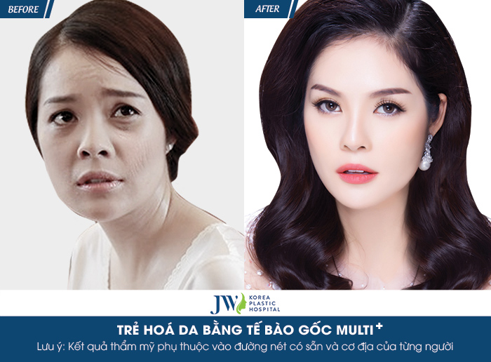 Dương Cẩm Lynh: “Dù bận rộn, tôi vẫn lựa chọn JW để chăm sóc sắc đẹp”