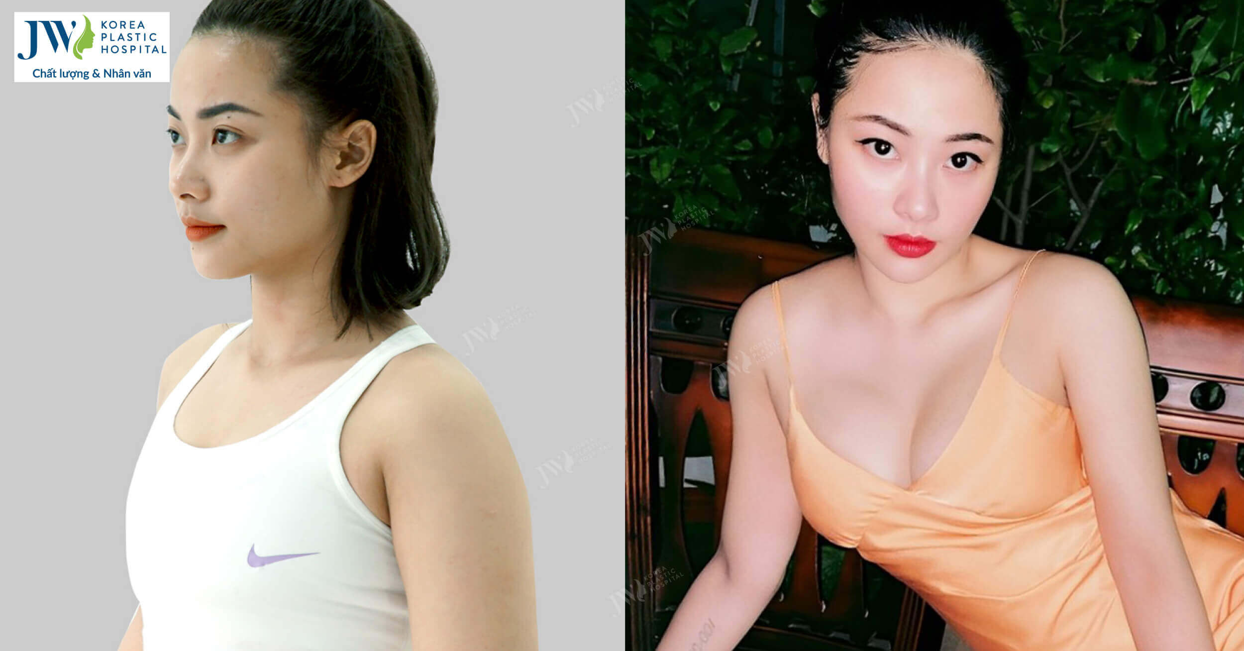 Nữ diễn viên Thanh Huyền góp mặt trong hàng loạt dự án phim Việt nổi tiếng sau phẫu thuật nâng ngực