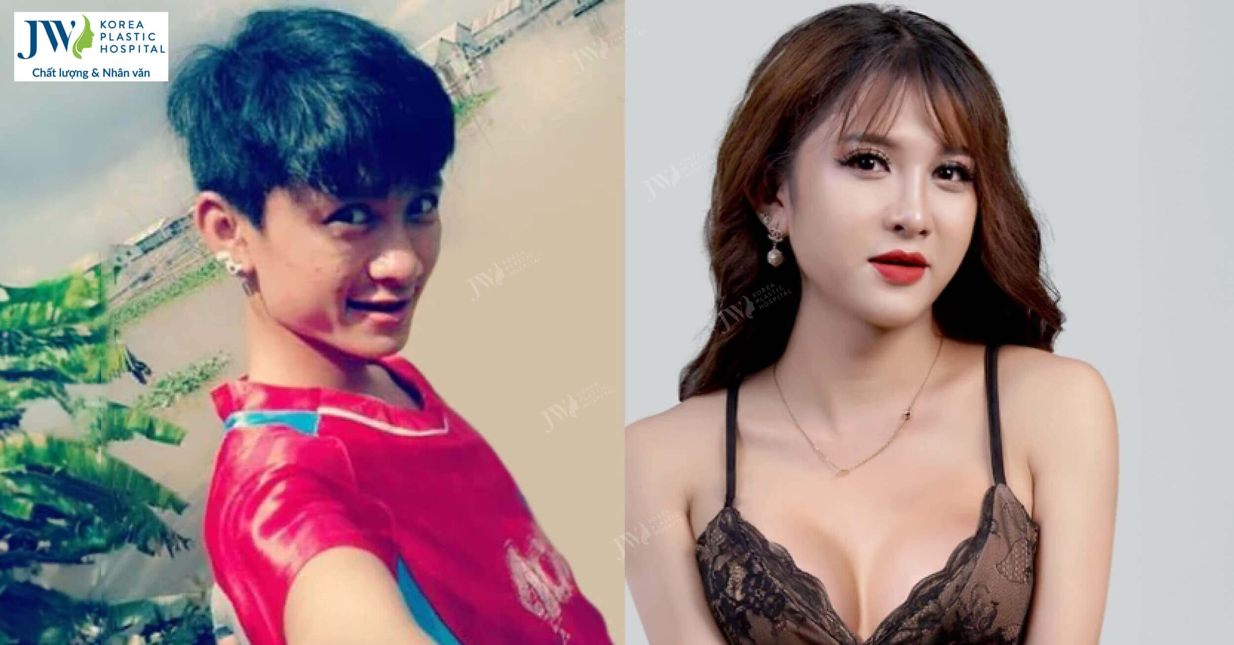 “Bóng Long Xuyên” và hành trình gian nan để sống thật với giới tính