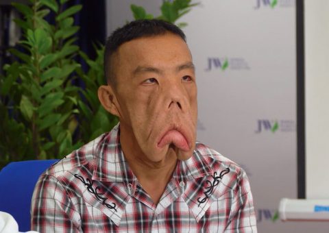 Anh Mến và Lời giải nào cho bác sĩ gây mê?