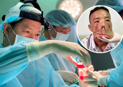 GƯƠNG MẶT CHẢY XỆ CỦA ANH MẾN – THÁCH THỨC LỚN TRONG Y KHOA