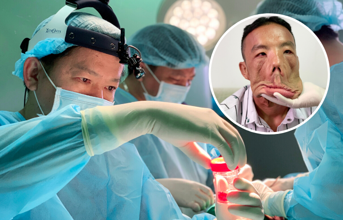 GƯƠNG MẶT CHẢY XỆ CỦA ANH MẾN – THÁCH THỨC LỚN TRONG Y KHOA