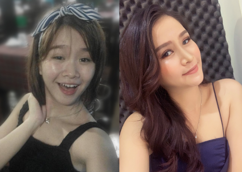 Nữ diễn viên Cổng mặt trời phát cuồng với nhan sắc của cô gái sau nâng mũi