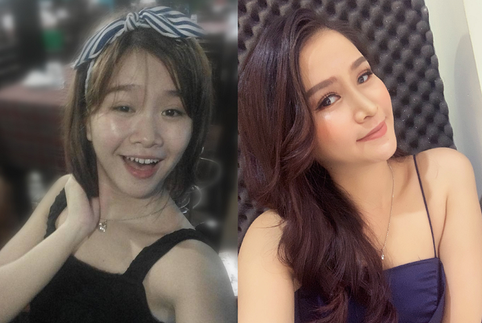 Nữ diễn viên Cổng mặt trời phát cuồng với nhan sắc của cô gái sau nâng mũi