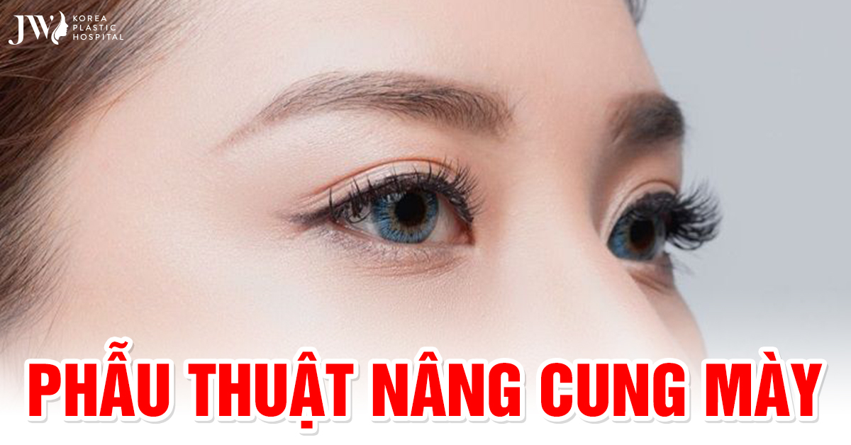 Phẫu thuật nâng cung mày hồi xuân đôi mắt chỉ sau 45 phút