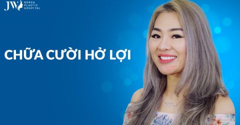 Chữa cười Hở Lợi – Tự Tin Khoe Sắc Cùng Nụ Cười Xinh