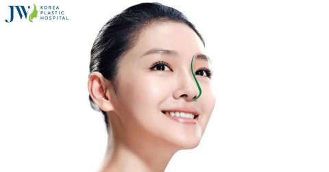 Giải đáp thắc mắc nâng mũi bao lâu thì đẹp cho hội chị em