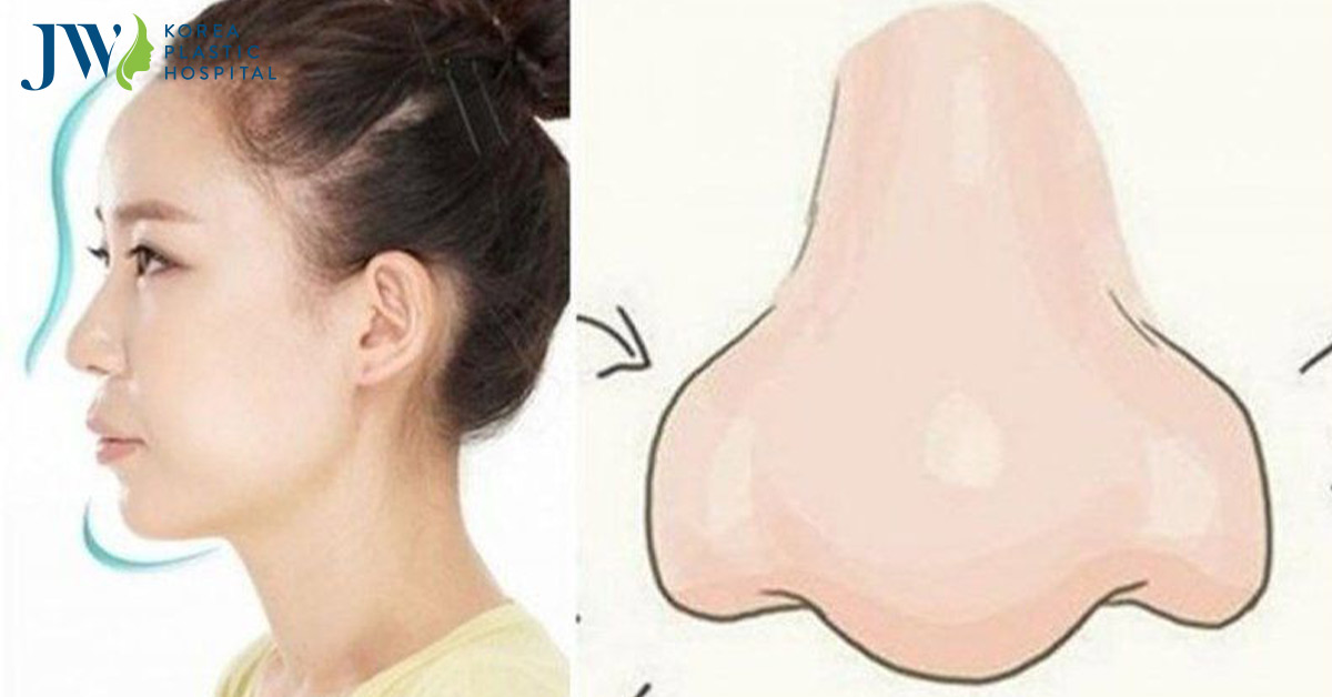 Mũi cà chua theo góc nhìn của phong thủy nhân tướng học Á Đông