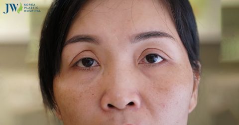 Mang thật nhiều yêu thương đến những mảnh đời khiếm khuyết