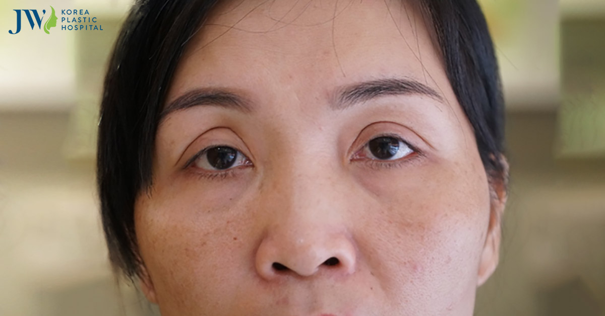 Mang thật nhiều yêu thương đến những mảnh đời khiếm khuyết
