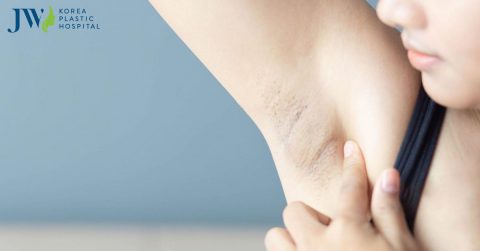 Cách tẩy triệt lông nách tại nhà với nguyên liệu từ thiên nhiên cực hiệu quả