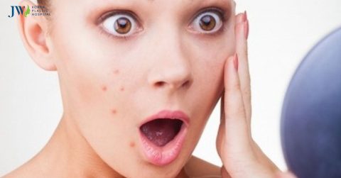 Cách trị mụn trứng cá tại nhà phụ hợp với học sinh sinh viên