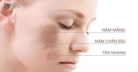 Cách trị nám bằng lá tía tô – Bài thuốc từ ngàn xưa